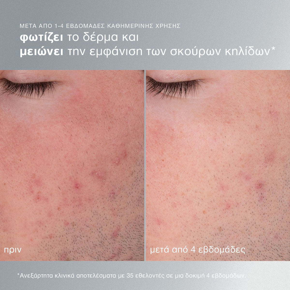Daily Microfoliant 40g - Dermalogica | Καθημερινό Peeling Προσώπου