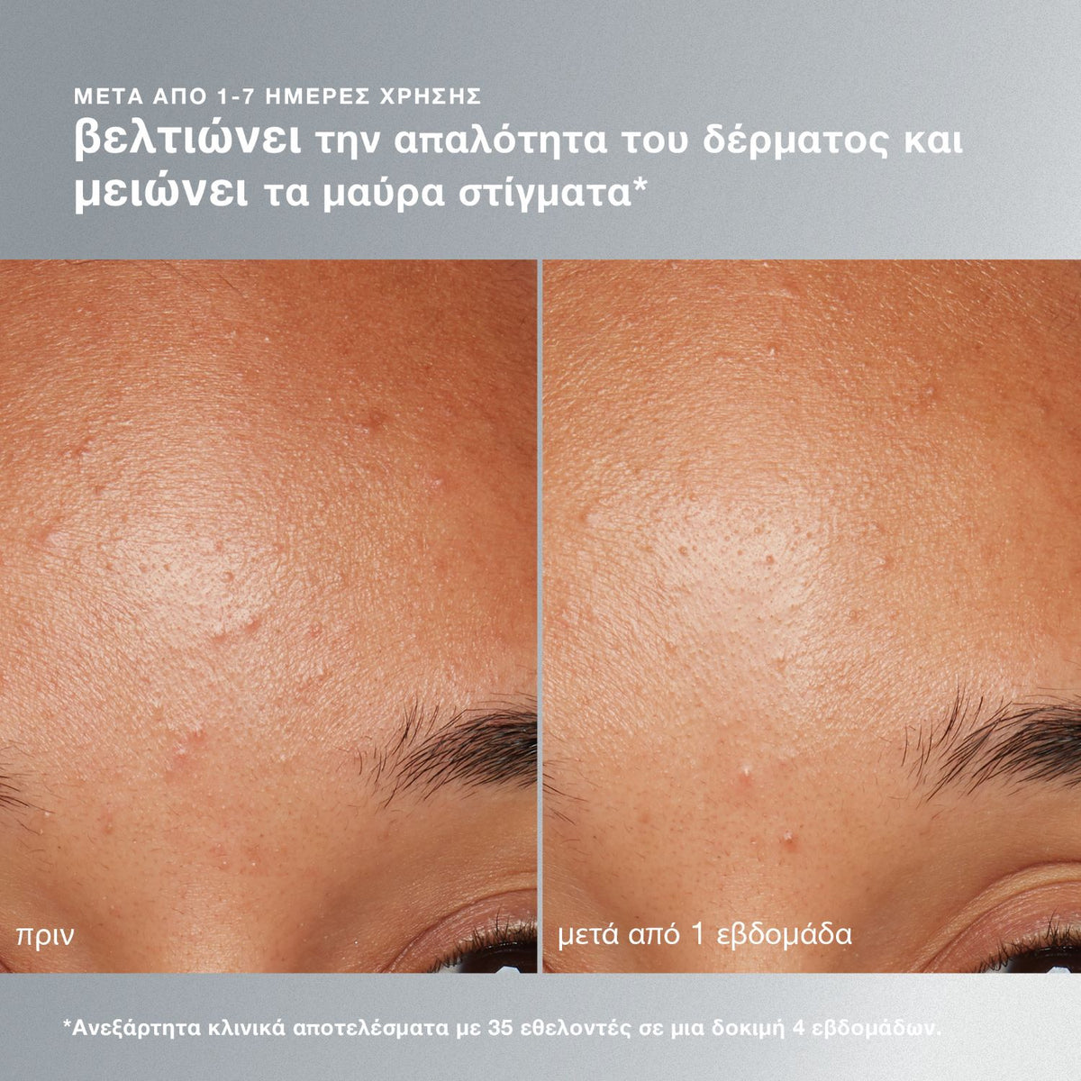 Daily Microfoliant 13g - Dermalogica | Καθημερινό Peeling Προσώπου